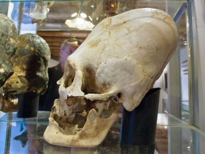 izduzivanje-lobanje-0311747935